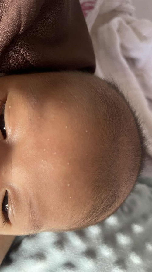 Ada bintik putih di dahi