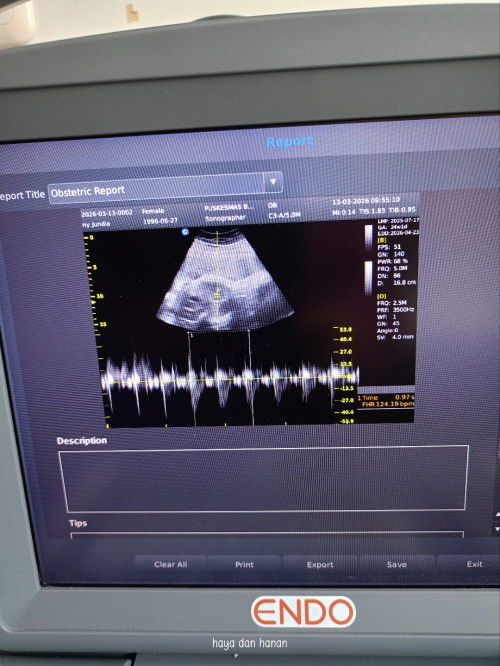 Minggu 34 bismillah april