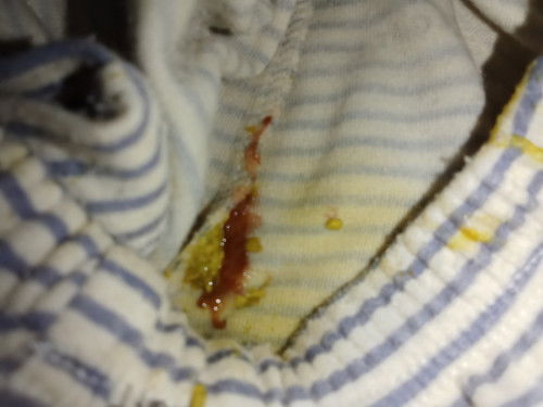 Bab bayi 6 bulan 14 hari ada bercak darahnya