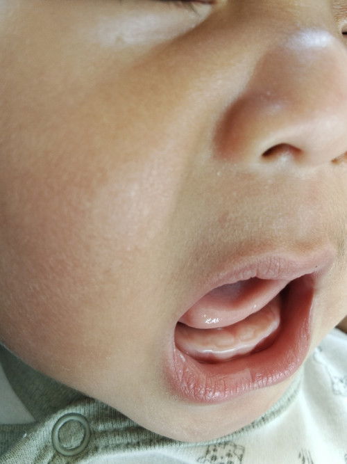 ปกติฟันจะขึ้นอายุกี่เดือนนะคะ