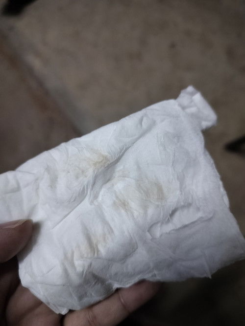 แบบนี้เป็นอะไรไหมคะ แม่ๆ ท้อง 8 สัปดาห์คะ