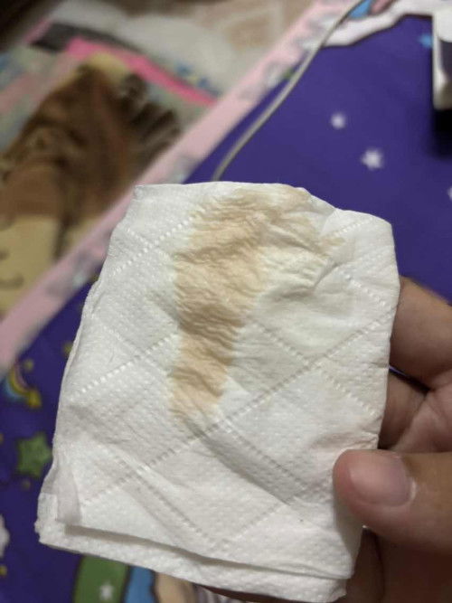 ท้อง37+5  ออกแบบนี้ สีเดือด รึสีชี้เราค่ะ ขอคำแนะนำหน่อยค่ะ แบบนี้ต้องไปโรงบาลไหมค่ะ