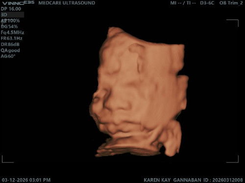 Hello sa mga mommies due June 2026!