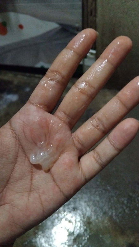 ตอนนี้39+1วีค