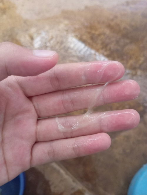 ตกขาวหรอคะท้องเเรก