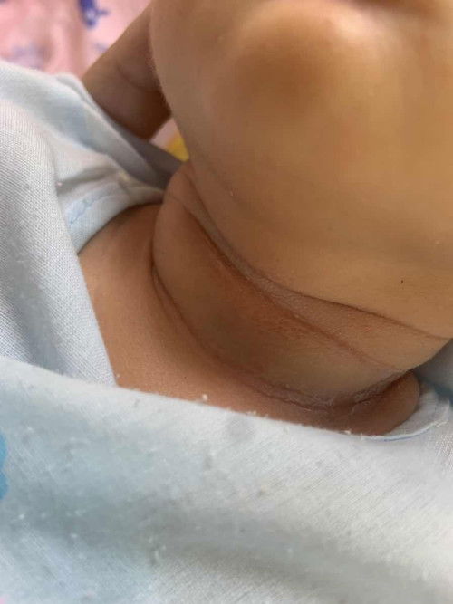 คอน้องเป็นแบบนี้ทำไงดีคะ