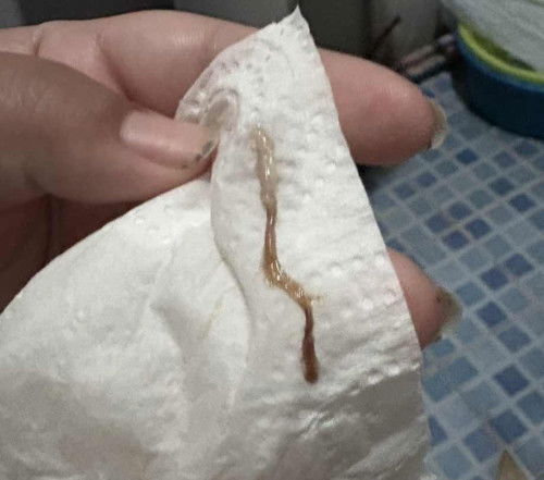 มีเลือดนิดหน่อย