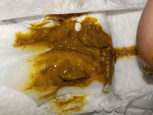 Baby minum susu formula S-26 baby