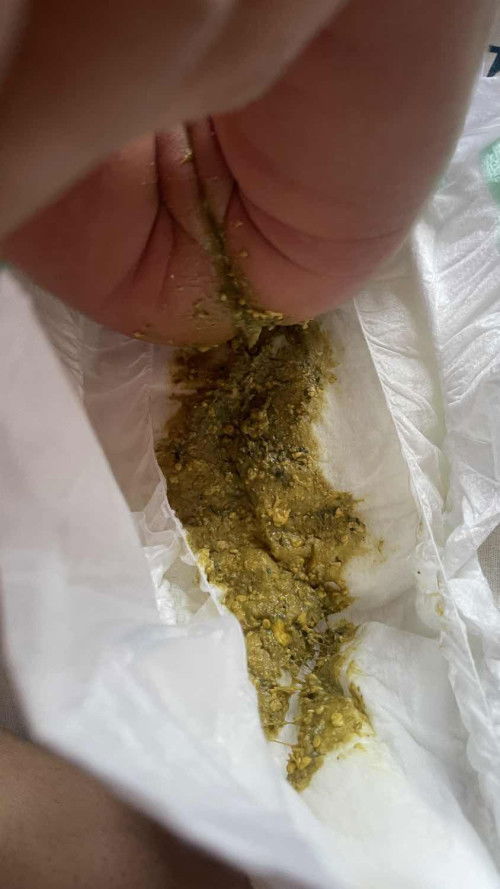 สอบถามแม่ๆๆๆๆ