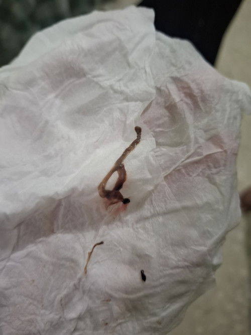 Harus bagaimana? Dan apakah berbahaya? Mengapa tiba" keluar lendir ya bun? Usia kehamilan 12minggu