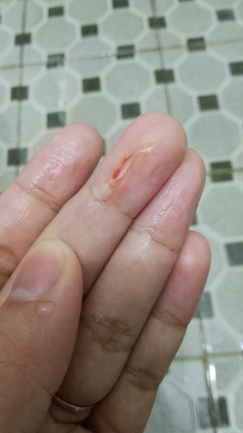 keluar lendir dan bercak darah