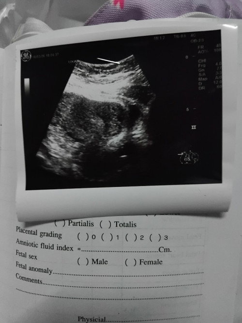 แม่คิดมากเรยอยากมาสอบถาม