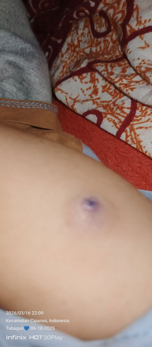 Ada yang sama nggx Bun??