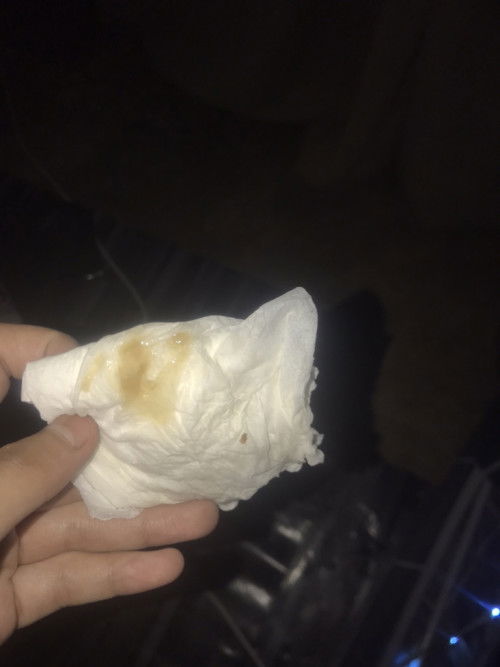 แบบนี้ควรหาหมอมั้ย