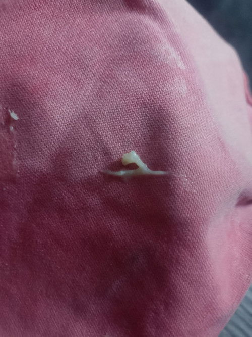 Plema I'm pregnant po 23 weeks 3 days