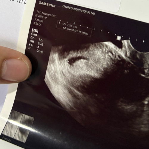 ไปซาวตอน 6 w 2 วัน ตอนนี้ครรภ์ประมาน 7 สัปดาห์ หมอนัดฝากครรภ์ 11 w ถุงตั้งครรภ์แบบนี้ ปกติมั้ยคะ จะเจอน้องมั้ยคะ