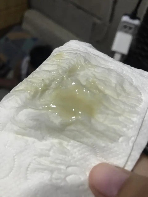 Mucus plug na poba ito?