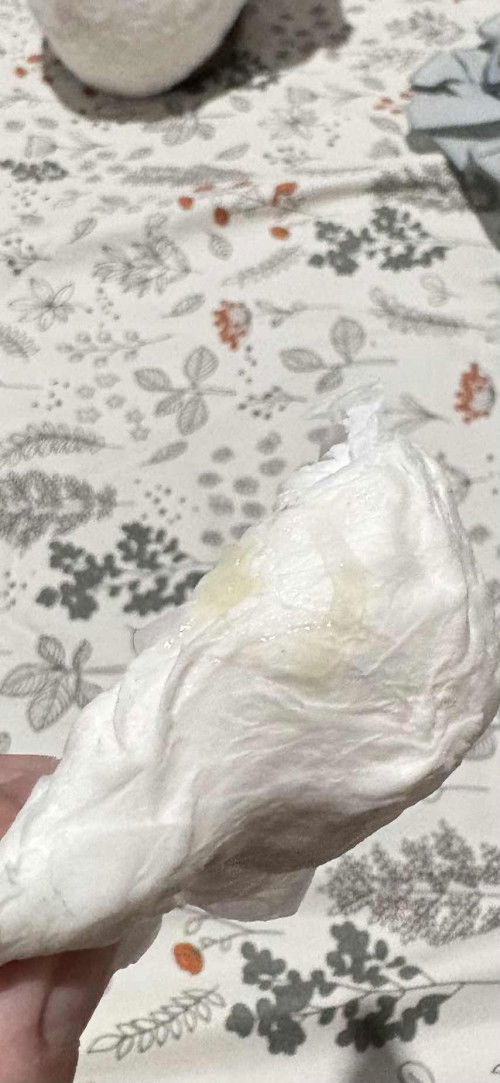 lendir tidak ada darah