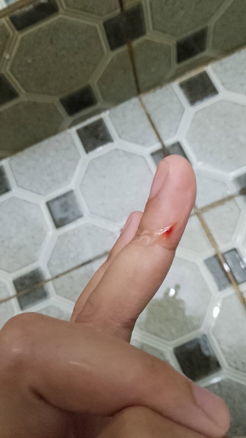 hamil 6 minggu selalu ngeflek kaya gini,udh minum obat penguat tpi selalu gini, bahaya gk ya bund🥺