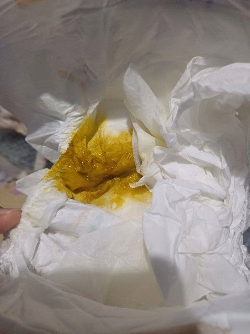 Apakah anak saya diare