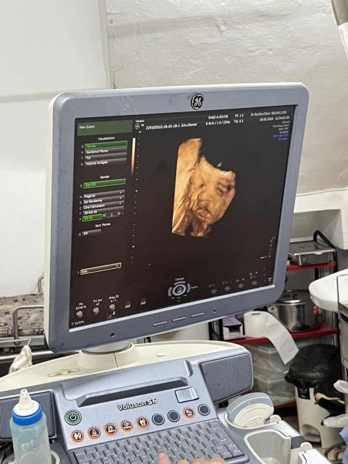 ขออนุญาตถามแม่ๆนะคะ