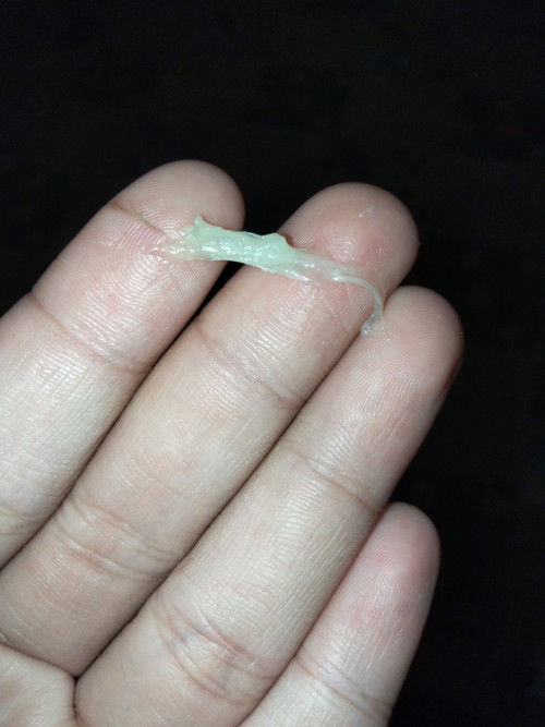 เเบบนี้คืออะไร