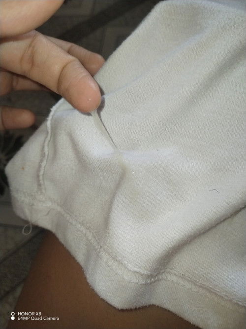 21 weeks preggy normal lang po ang ganitong discharge clear na parang sipon