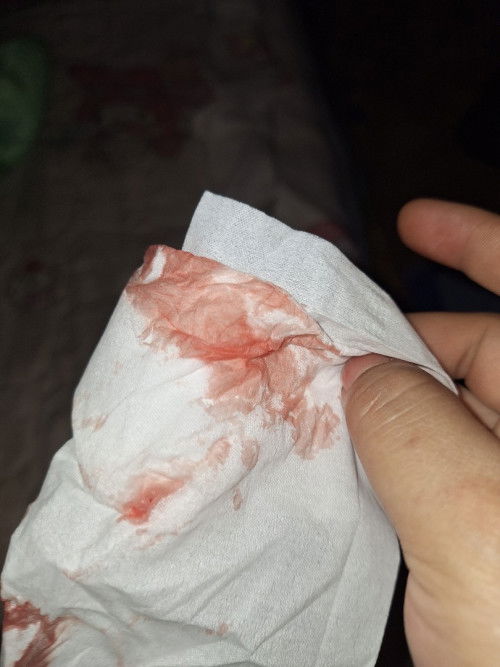 ท้องแรก#ลูกคนแรก