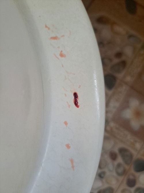 9วีค3วัน ปัสสาวะแล้วมีแบบนี้ปนออกมา อันตรายมากไหมคะ พึ่งมีแบบนี้ครั้งแรก ท้องแรกค่ะ