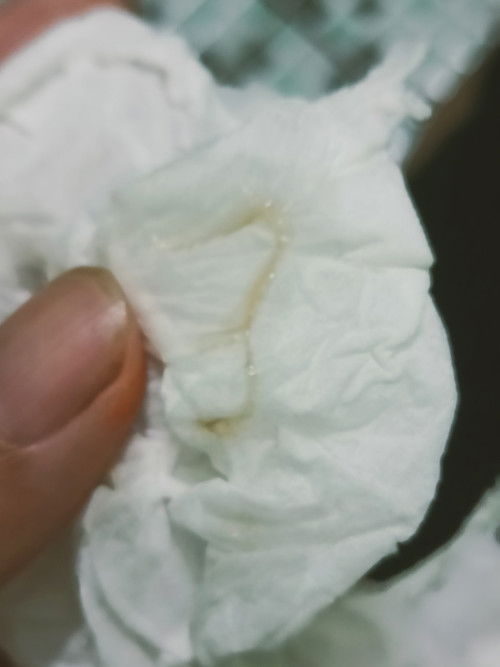 ตั้งครรภ์12วีค