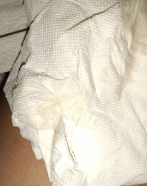 อันนี้คือมูกเลือดรึป่าวคะแต่มันไม่มีเลือดเป็นวุ้นๆใสๆ 38+8วีคค่ะ