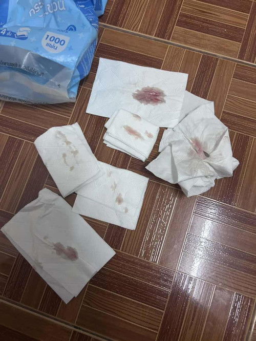 ท้องได้13w ช่วงตี5มีเลือดไหลออกแบบนี้คืออะไรหรอคะ  เกิดจากสาเหตุอะไร