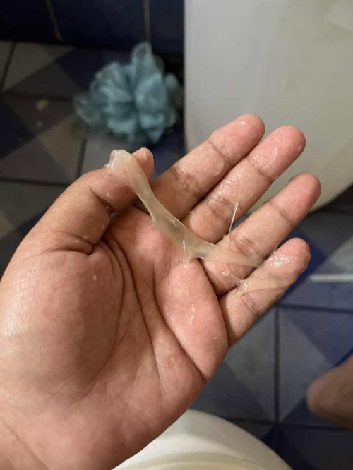 มีมูกแบบนี้ปกติไหมคะต้องไปหาหมอไหม