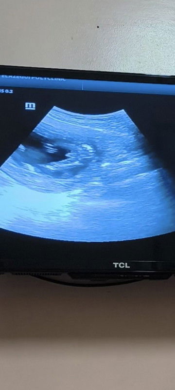 Sure na boy na po ba ? I have 2 girls na po kasi hoping na baby boy na itong 3rd baby ko