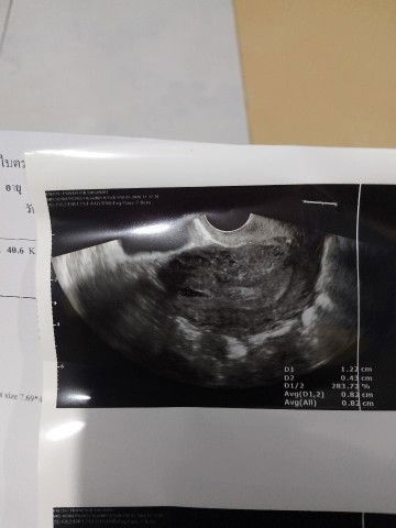 ขอสอบถามแม่ๆค่ะ