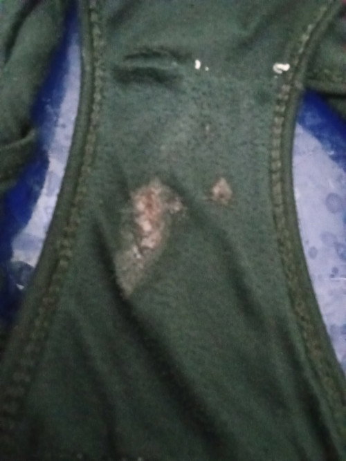 Baru 5 Minggu 4 hari keluar darah