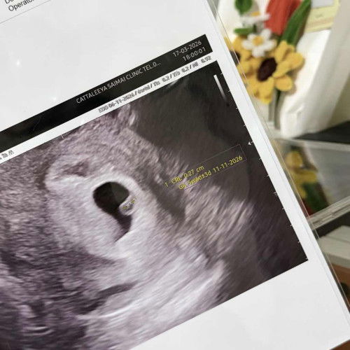 6w4d เจอหัวใจจิ๋วๆแล้วนะคะ 💗