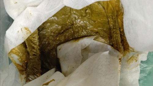 ให้น้องมากินs26กล่องอึแบบนี้ 4วัน1ครั่งค่ะ