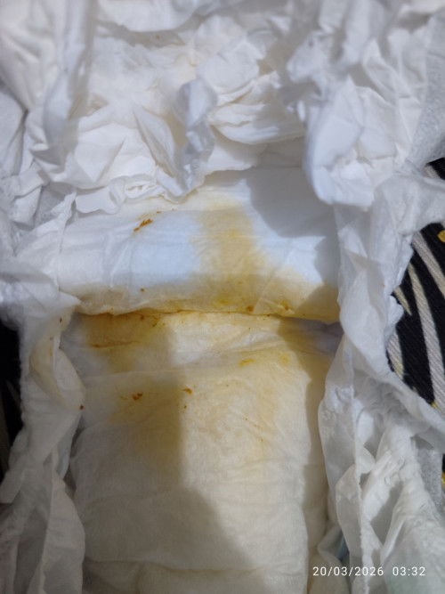 Maaf mau tanya bun, kalau pup nya 1 hari cuma 4x diusia 26 hari dan pupnya seperti ini apakah normal