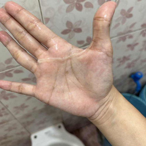 normal lang poba ito