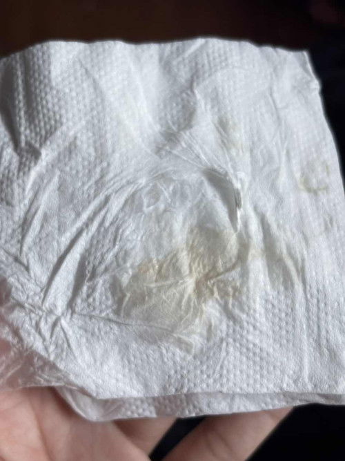 Bunda bunda ini flek apa bukan ya di kehamilan 13 week