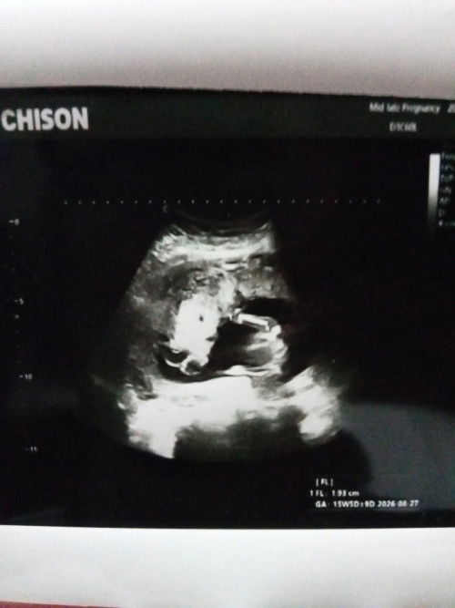 แม่ๆช่วยดูให้หน่อยได้ไหมคะว่าในภาพคือส่วนไหนของน้องค่ะ