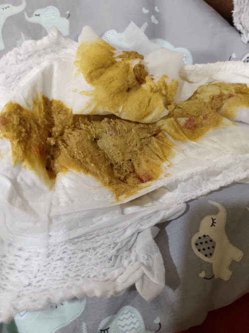 Najis Anak Tukar Susu