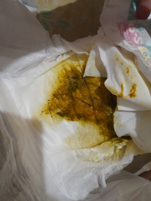 Mau tanya bun, maaf jorok, anak saya mau 1 bulan, full asi dbf, hari ini kok bab nya kaya gini kenap