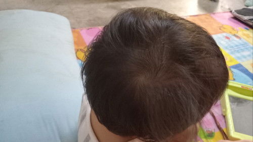 มีขวัญด้านขวา