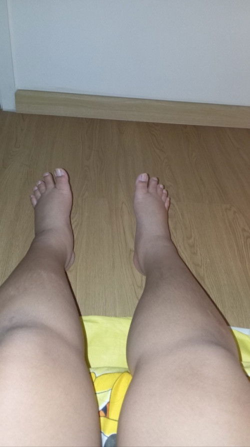 ขาบวมเท้าบวม