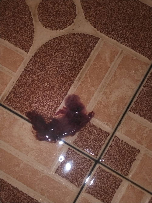 Seputar flek PD kehamilan