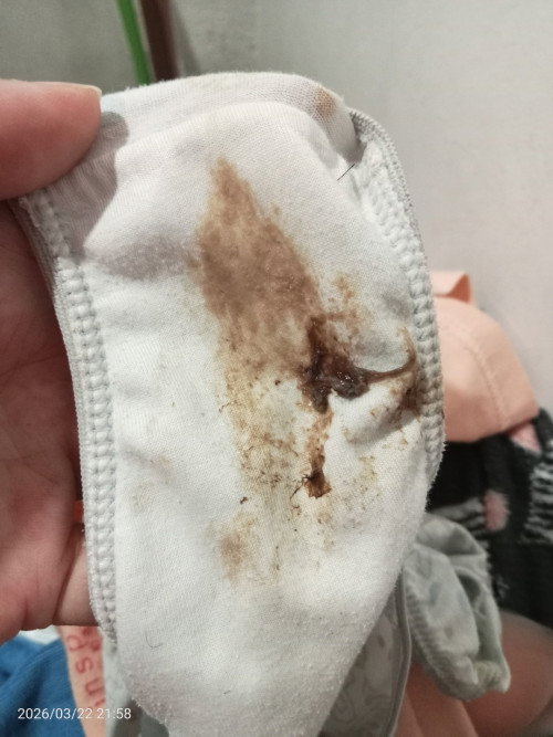 Hello po.
Tumitigas po tyan ko and medyo masakit. 
Tapos may lumabas po sa akin kulay brown.