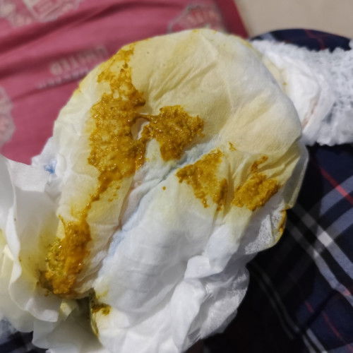 Pup seperti ini normal atau tidak