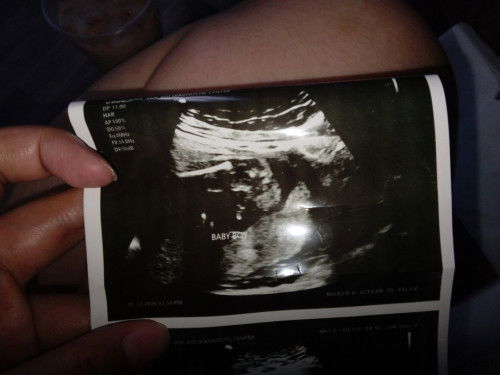 Ask lang po if baby boy po talaga sya hehe excited lang po